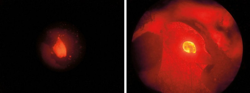 unmarkiert - markiert